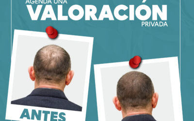 Resultados naturales